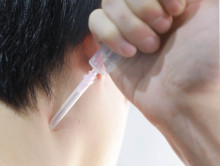 耳膜穿孔验伤标准是什么
