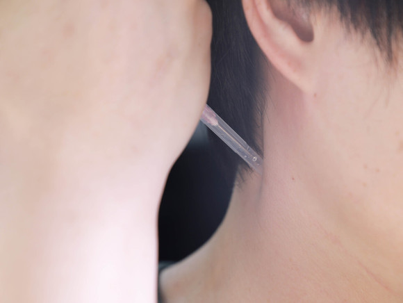 被打聋一只耳朵，最低赔偿是多少