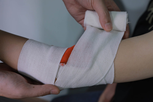 小孩脸部受伤一般怎么赔偿的